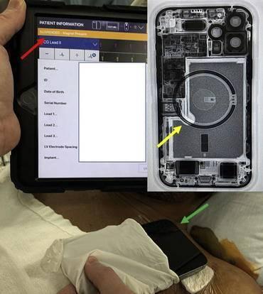 iPhone 12可能會(huì)影響植入式醫(yī)療設(shè)備正常運(yùn)行
